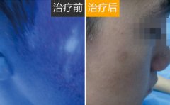 宁波最好的白癜风专科医院